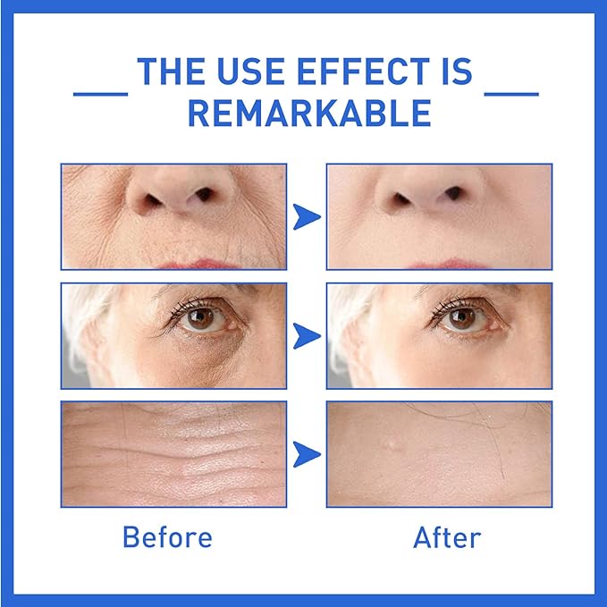 Make People Young Again Botox Anti Aging Serum, 3 Botox In A Bottle,90ML Botox Stock Solution Anti-aging Serum,botox Serum for Your Face,face Serum for Women Anti Aging The Best One (1PCS)